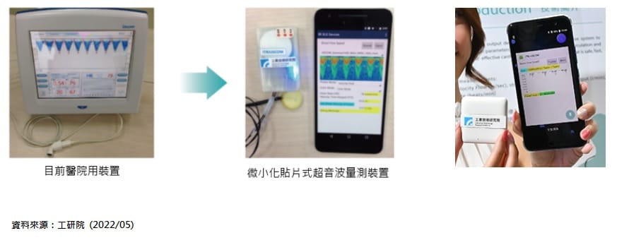 智慧醫電產業現況-工研院開發貼片式超音波心血管參數感測裝置